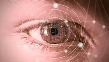 De ojo a las conexiones de red